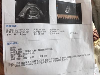 孕35周几个月