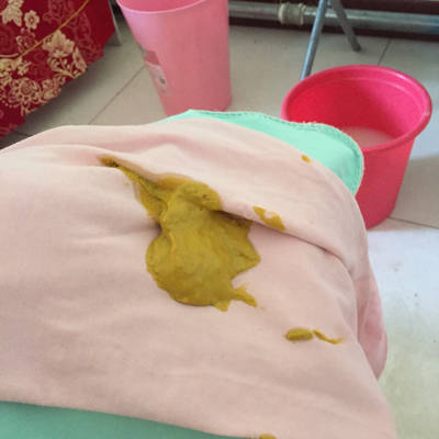 新生儿吃奶粉便秘拉不出来怎么办