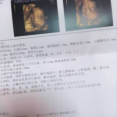 怀孕六个月做四维晚吗