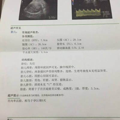 怀孕七个月的胎儿有多重