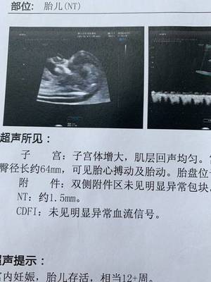 12周胎儿nt值正常范围