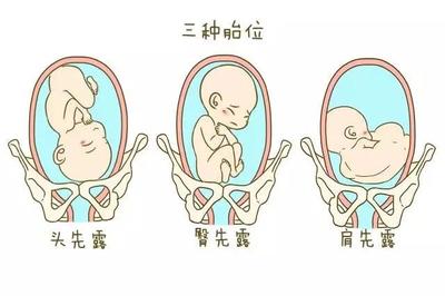 怀孕多久定胎位