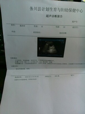 怀孕多少天孕吐