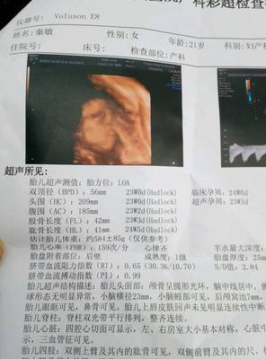 怀孕六个月胎儿有几斤