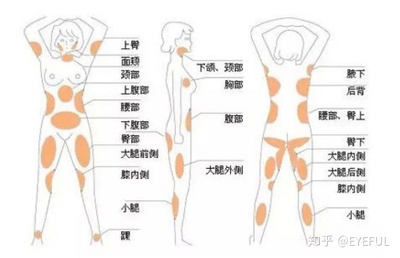 抽脂融脂