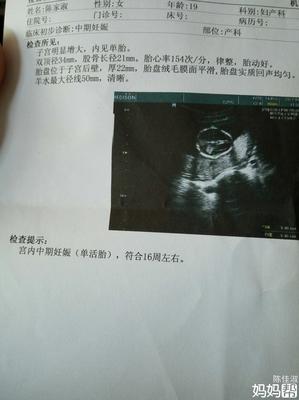 四个月胎动