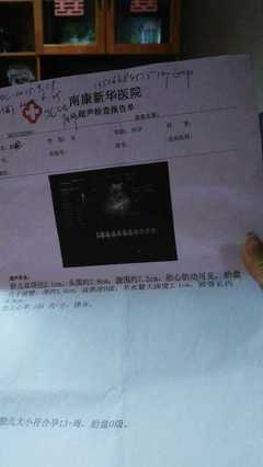 怀孕十七周有胎动吗