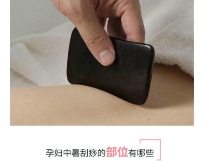 孕妇可以刮背吗