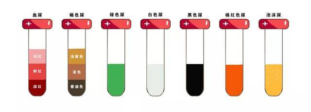 小便茶色是怎么回事