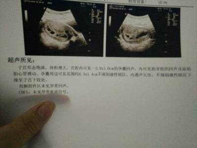 怀孕宫内有积液是怎么回事