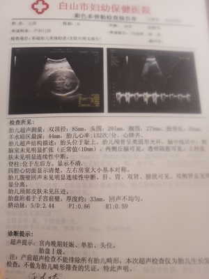 孕32周 胎儿心率多少次正常值