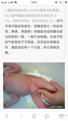 小儿疝气是怎么回事