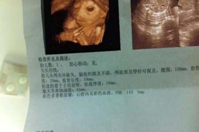 怀孕染头发对胎儿有影响吗