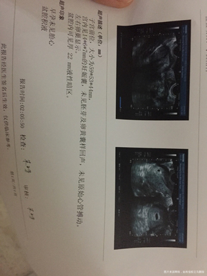停经8天能测出怀孕吗