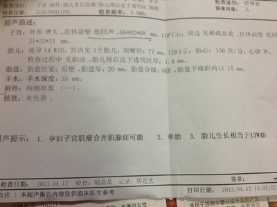 房子有回音有什么征兆
