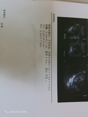 宝宝几周有胎心