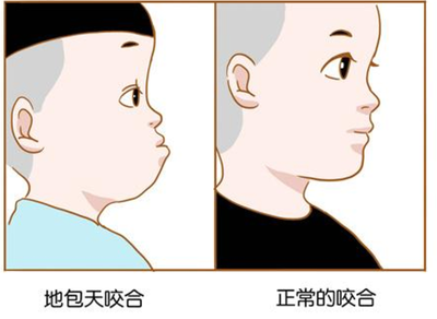 一岁地包天