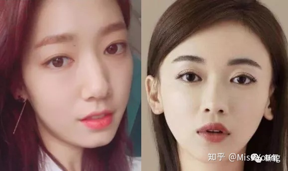 割了双眼皮后特后悔