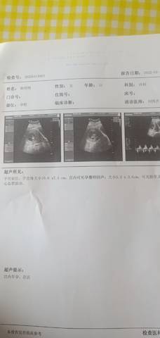 怀孕几周能看到孕囊