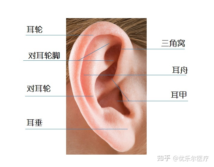 新生儿外耳畸形