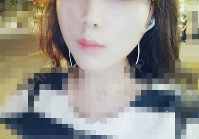敷了面膜后脸长小痘痘