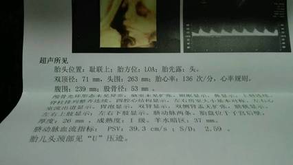 怀孕4周会恶心吗