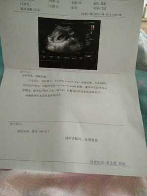 宝宝几周有胎心