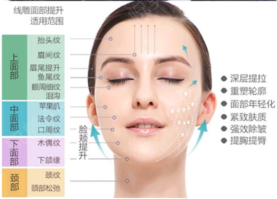 脸部埋线能维持几年
