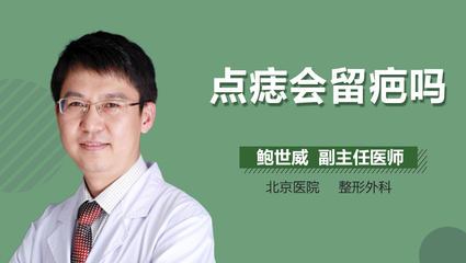 激光点痣会留疤