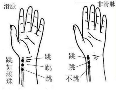 怀孕脉象图解