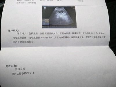 怀孕不吐正常吗