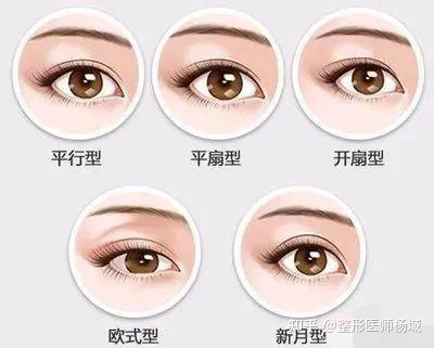 内眦赘皮双眼皮