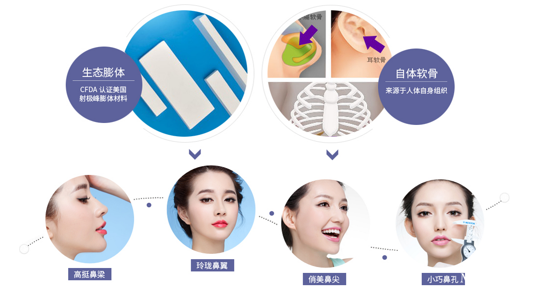耳软骨隆鼻容易歪吗