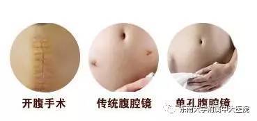 南京治疤痕中天就诊