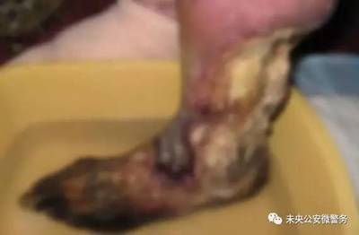 脚板发麻是怎么回事