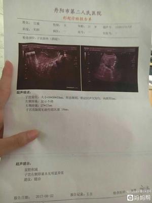 怀孕多久可以验血确认
