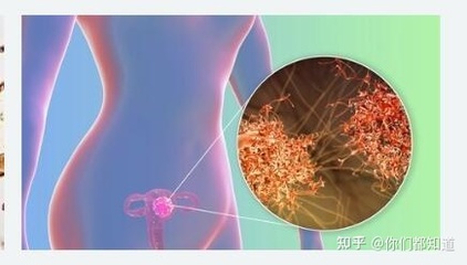 怀孕4周可以药流吗