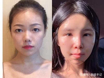 整容脸部