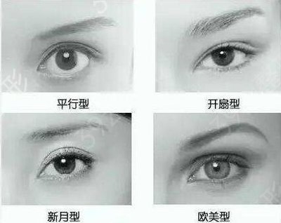 切割双眼皮费用