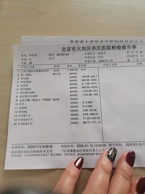 医院查排卵期怎么查