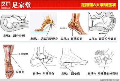 韧带劳损怎么治疗
