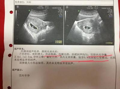 怎么才能确定是否怀孕