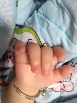 新生儿多久可以剪指甲