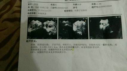 刚怀孕一周