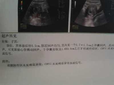 怀孕60天胚芽多大正常