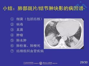 肺部病灶切除多少钱