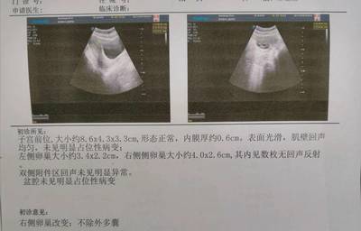 没排卵内膜多少正常