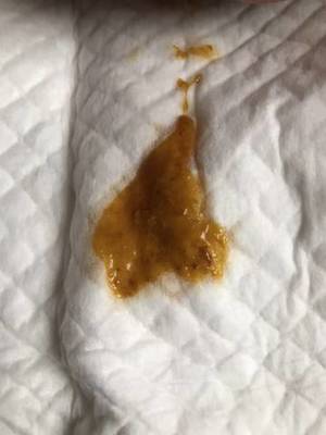 满月宝宝正常大便图片