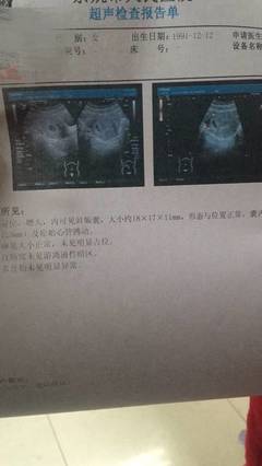 怀孕着床晚是什么意思