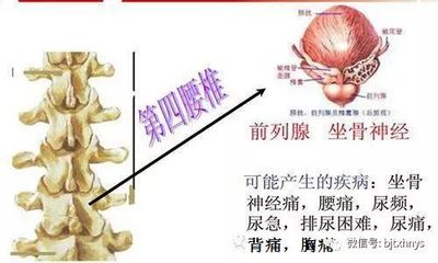 腰眼骨头疼是怎么回事